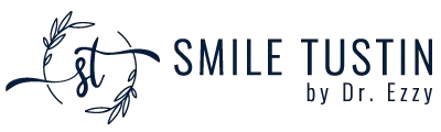 Dentist in Tustin, CA –  Smile Tustin by Dr. Ezzy